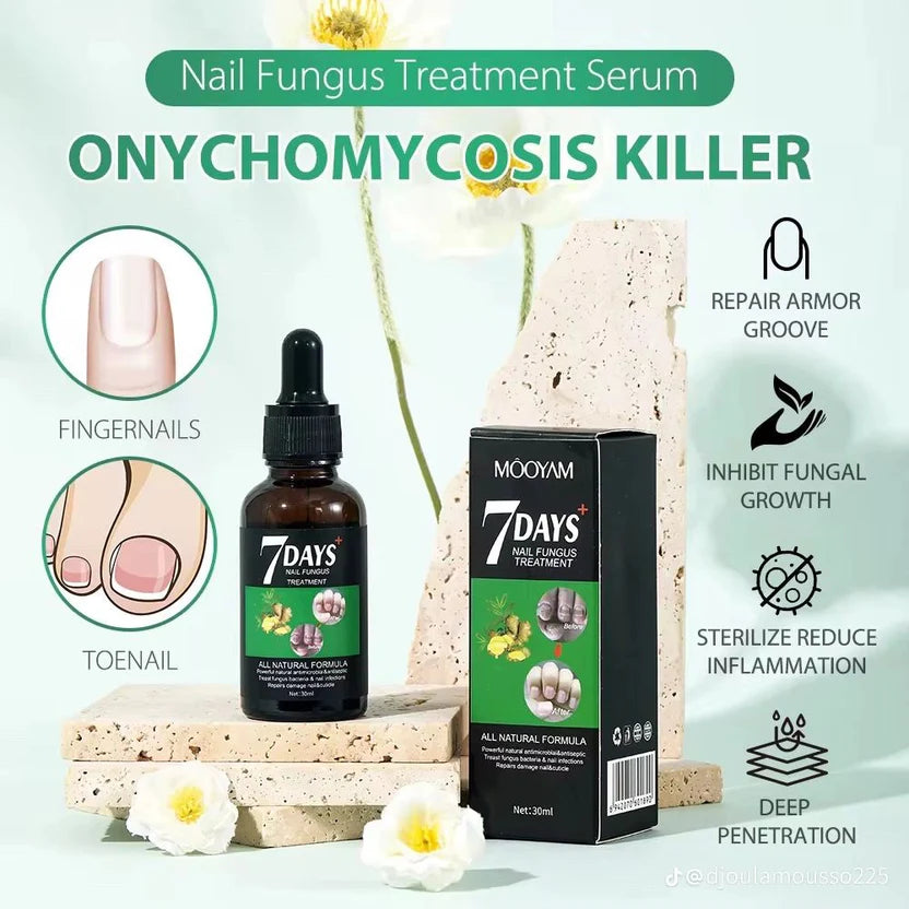 Comment retrouver des ongles nets et sains avec notre antifongique